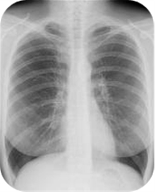 Radiologic Technology Program Application Fee